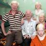 Интересные факты о людях, страдающих альбинизмом (24 фото)
